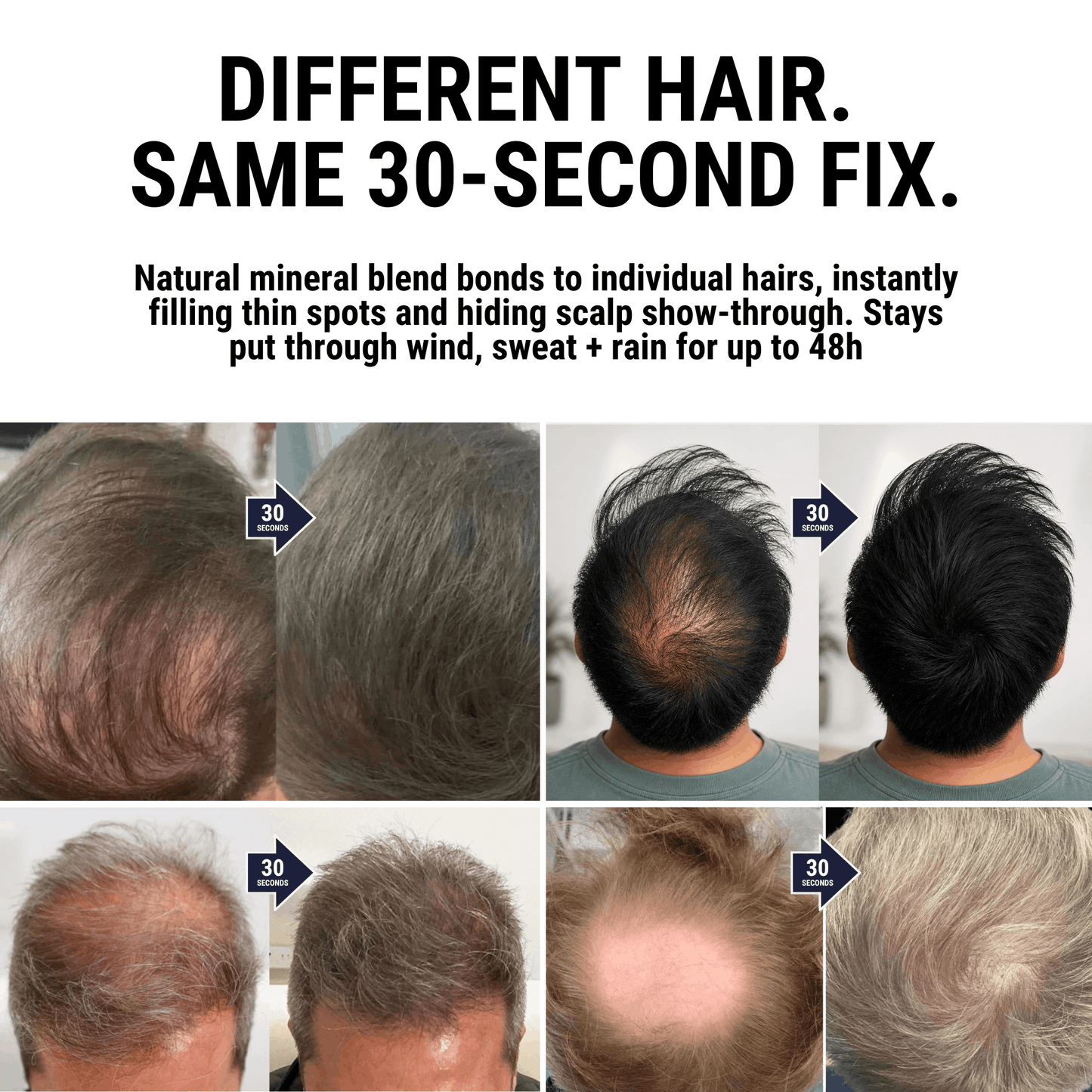 DENSIQ Pro - Instant Hair Density Filler "Secret Offer" Buy 1 Get 1 Free