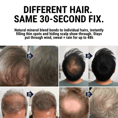 DENSIQ Pro - Instant Hair Density Filler "Secret Offer" Buy 1 Get 1 Free