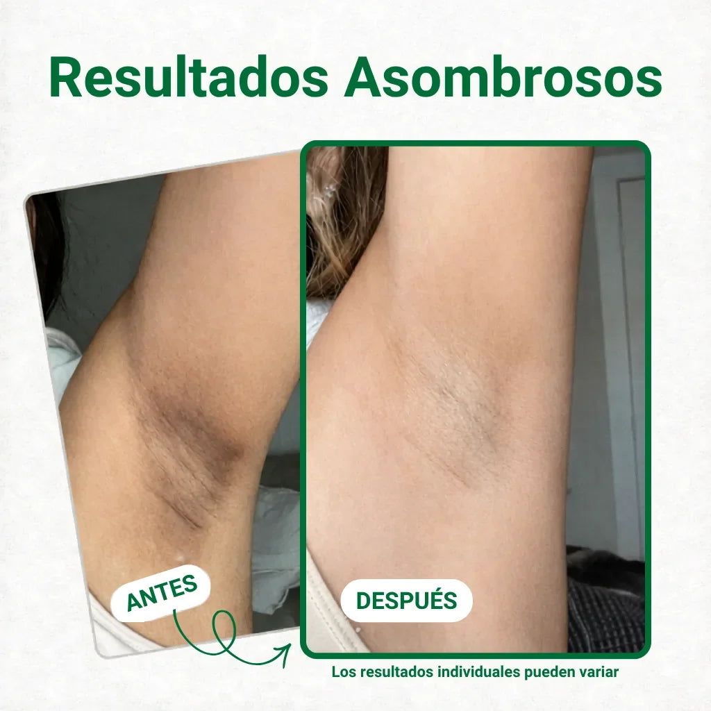 Parches despigmentantes y aclarantes