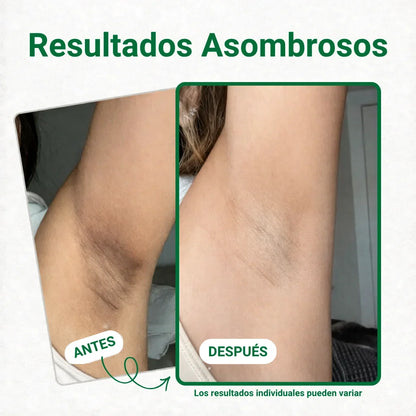 Parches despigmentantes y aclarantes