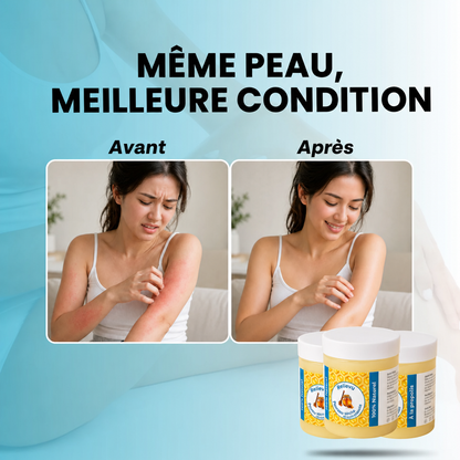 Soothe itching and provide intense daily hydration