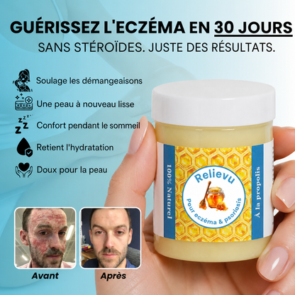 Soothe itching and provide intense daily hydration